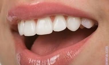 Сонник выпадение гнилых зубов К чему снятся гнилые зубы и выпадают